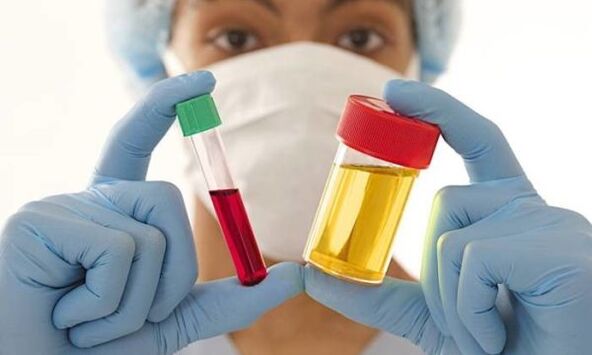 Analyses de sang et d'urine avant une opération d'augmentation mammaire