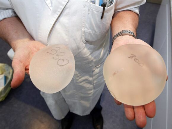 Implants mammaires pour l'augmentation mammaire