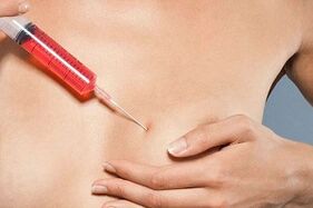 Injection mammaire pour l’augmentation de la graisse