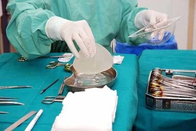 Préparer l'implant pour la chirurgie